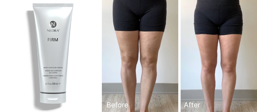 Images of a bottle of Firm Body Contour Cream and a before and after image of legs.